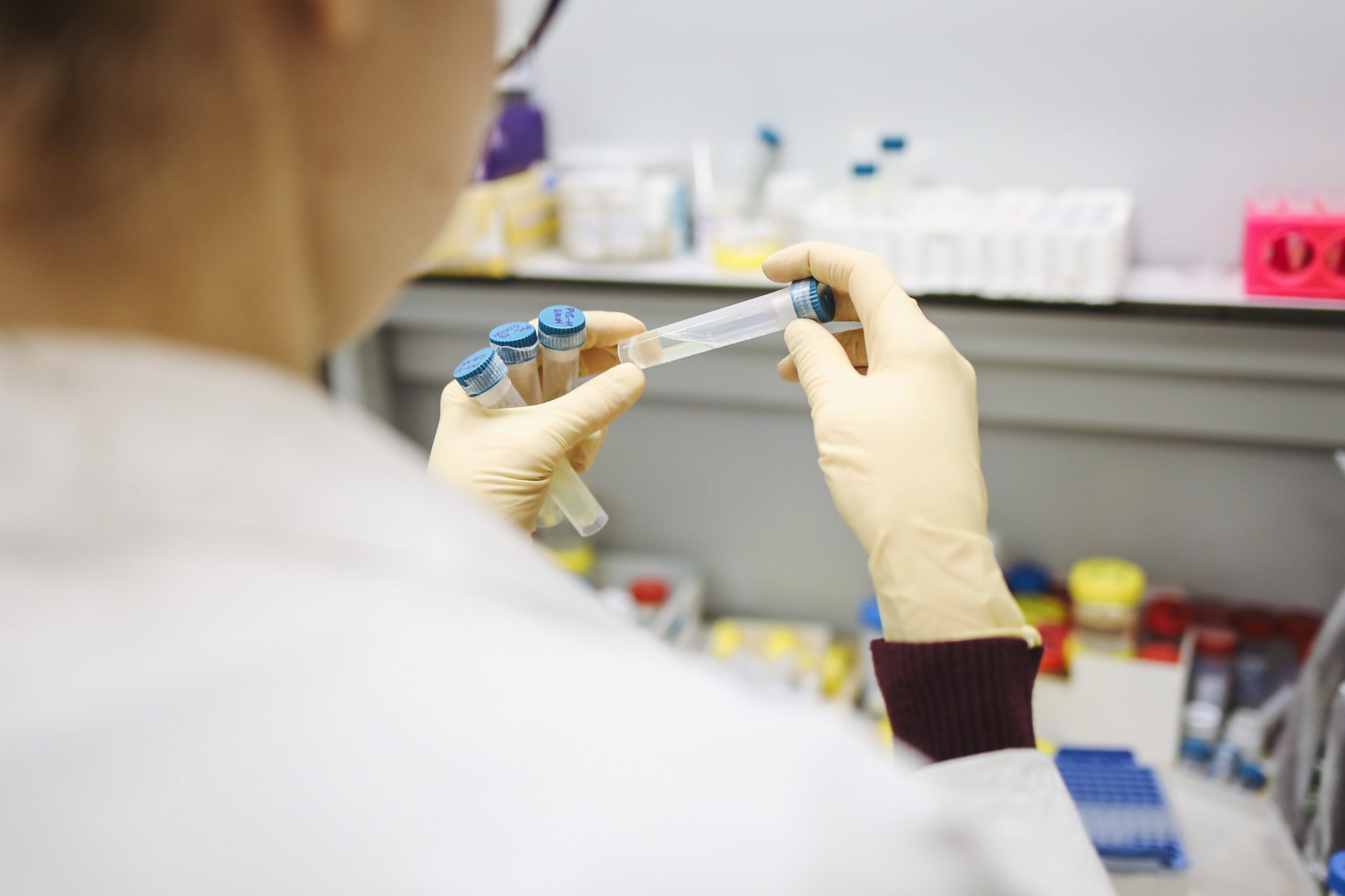 Under 50s: NHS bosses expect COVID jab shortage  in April yet vaccine makers deny claims
