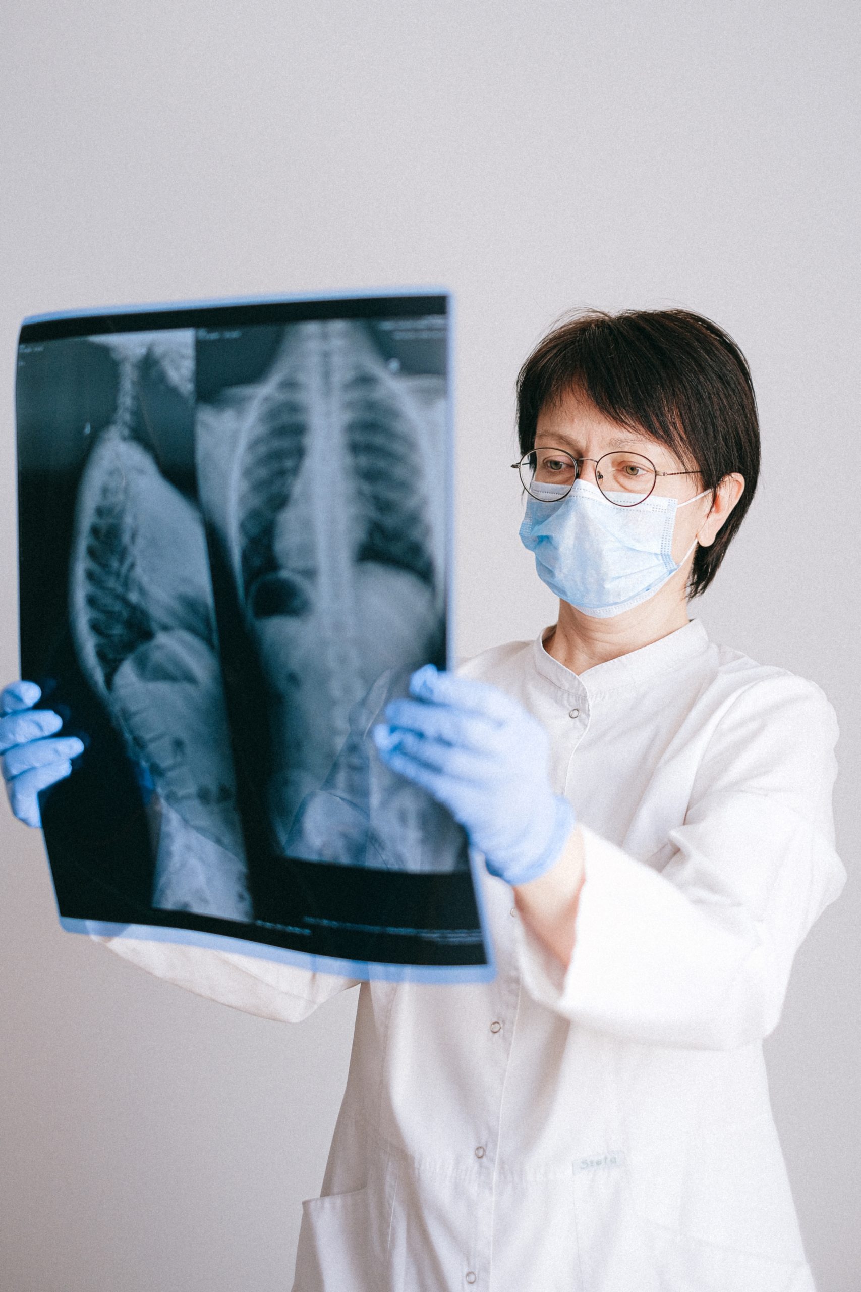 New research indicates NHS must ramp up rehab recruitment to cope with 'Long COVID' complications